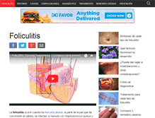 Tablet Screenshot of foliculitis.org